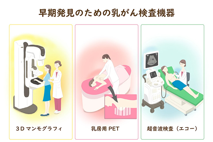 breast_cancer_4.jpg