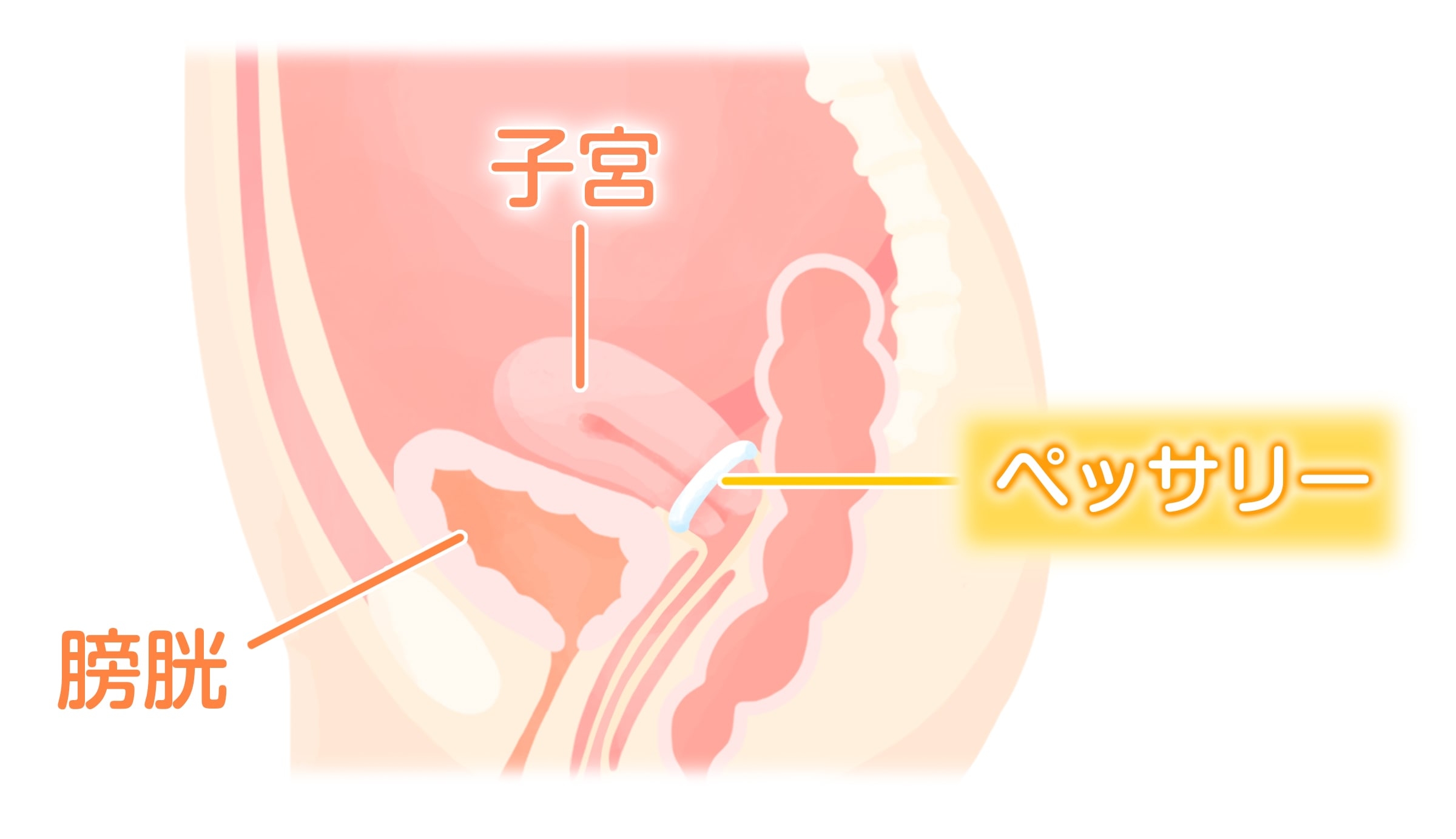 200以上 ペッサリー 画像 312755