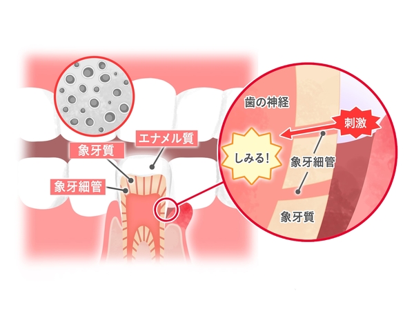 記事画像