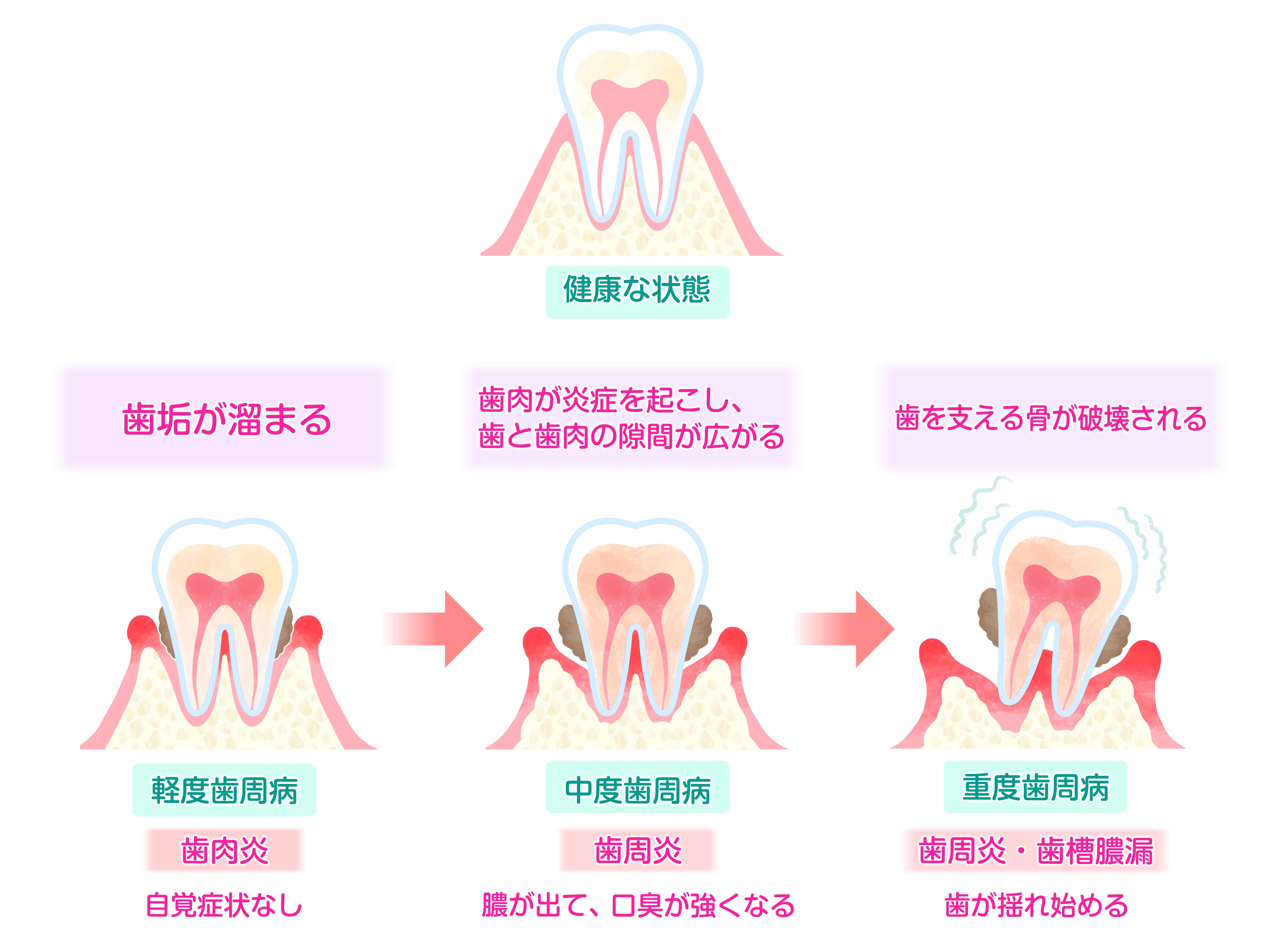 記事画像