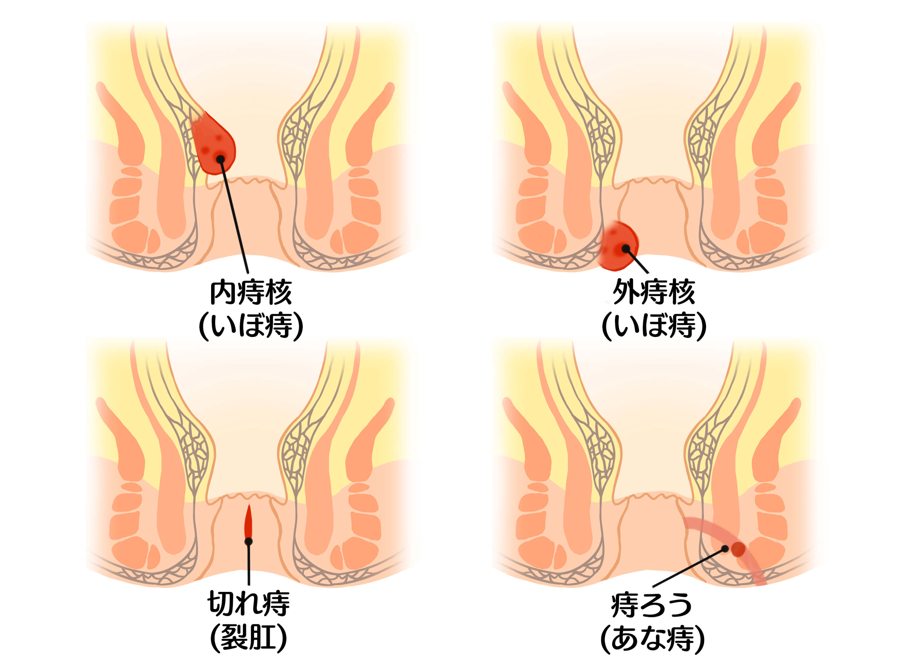 jinosyurui02菫ｮ豁｣.jpg