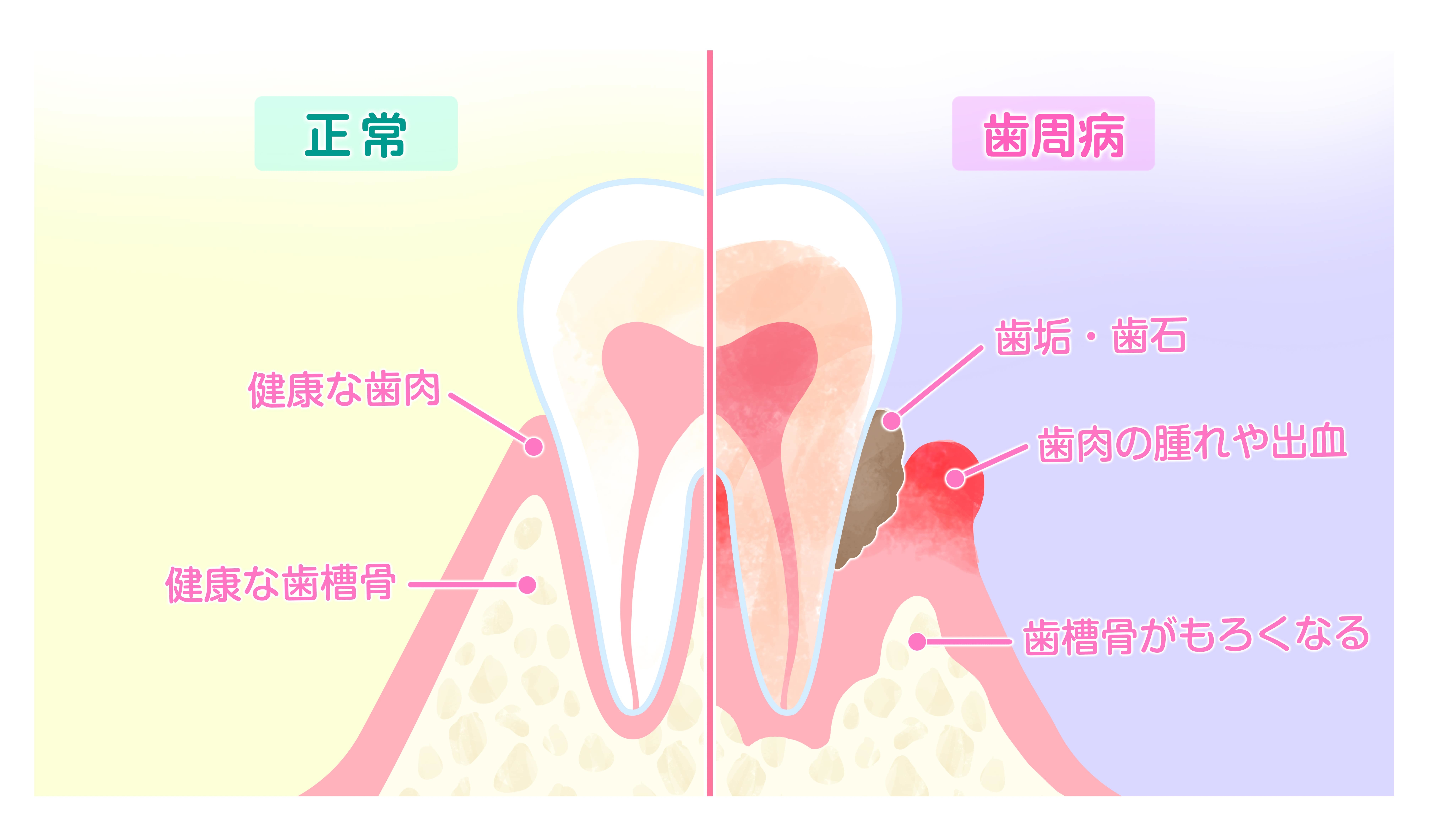 記事画像