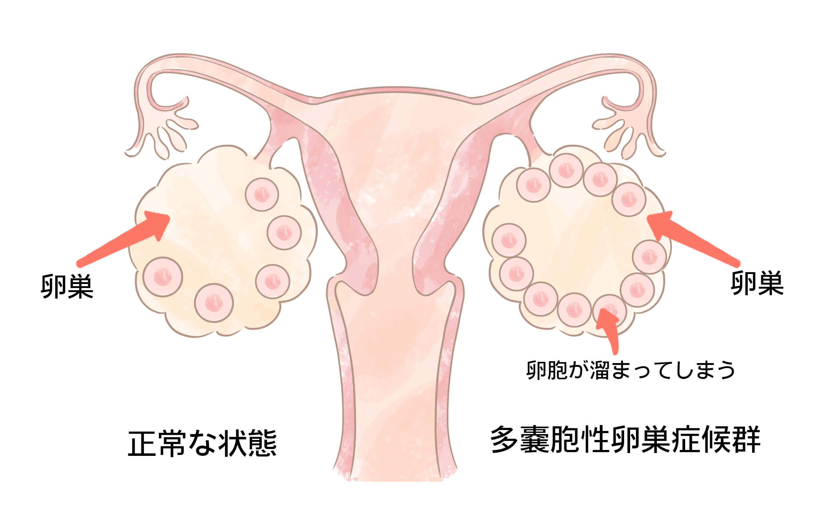 医師の診察を受ける時期