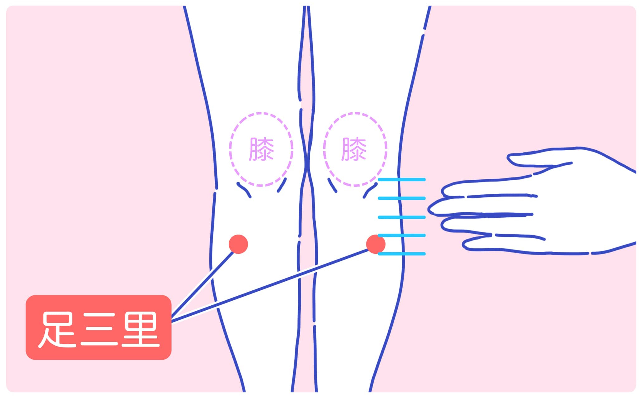 下肢静脈瘤_3-min (トリミング).jpg