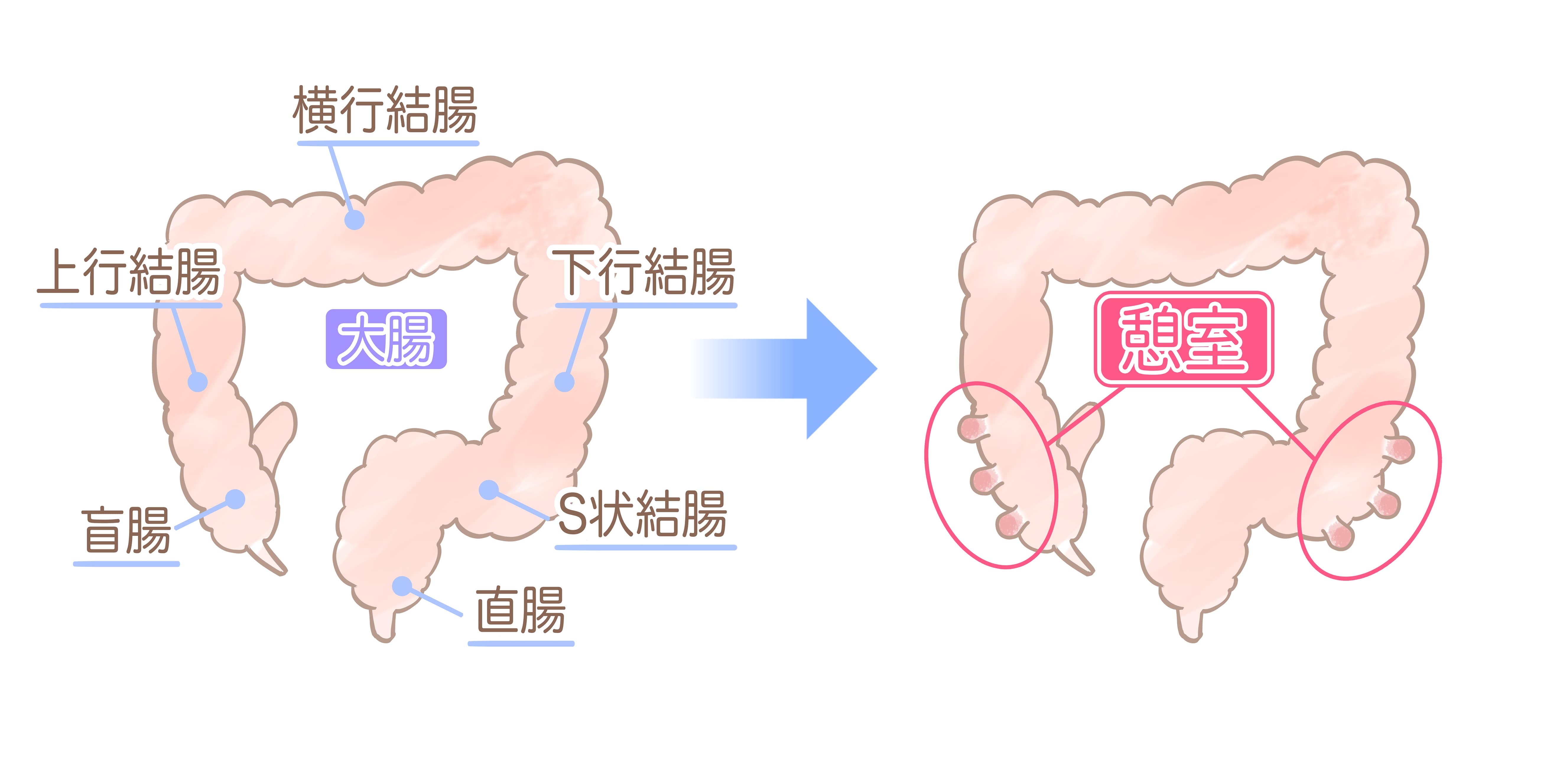 記事画像