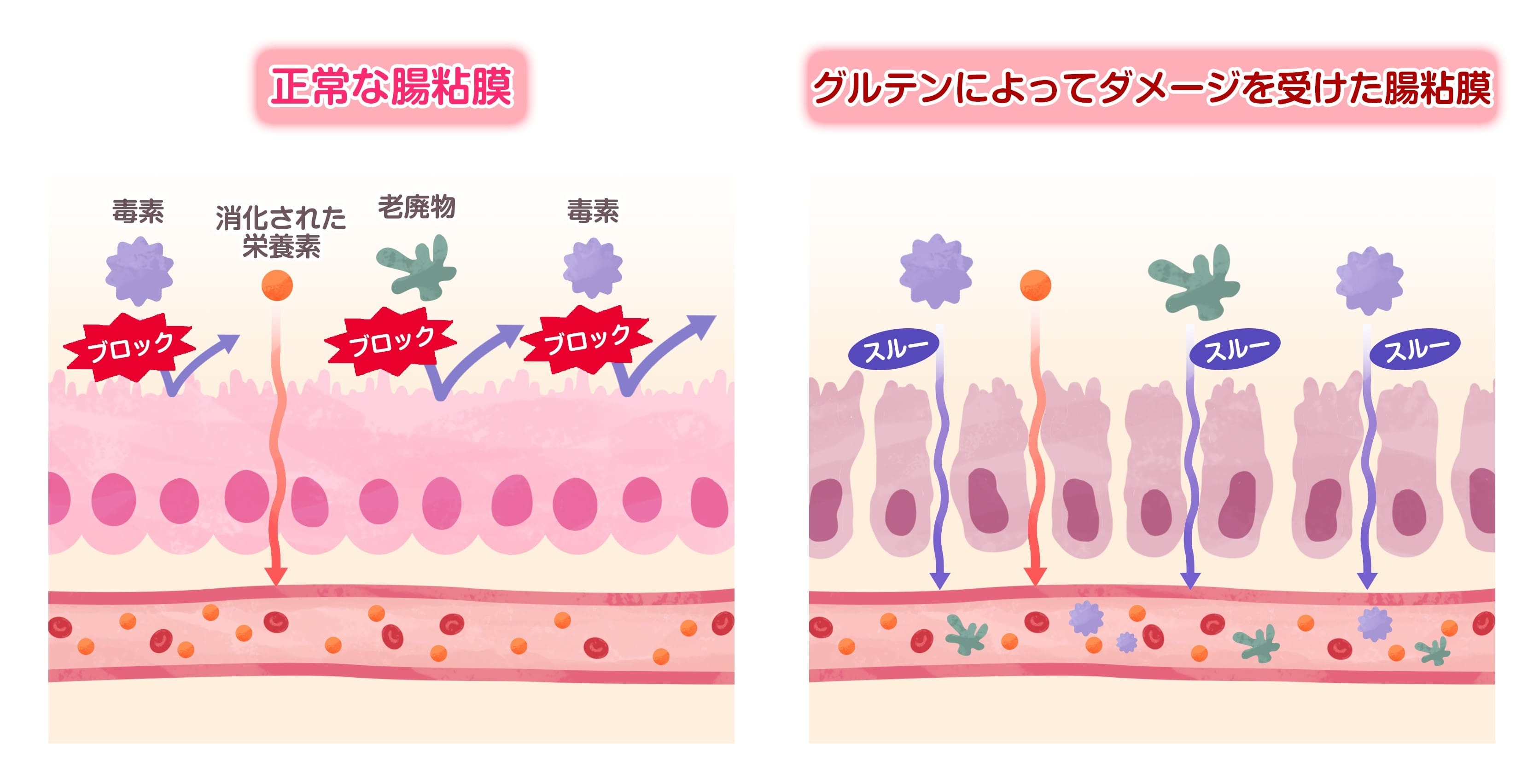 記事画像