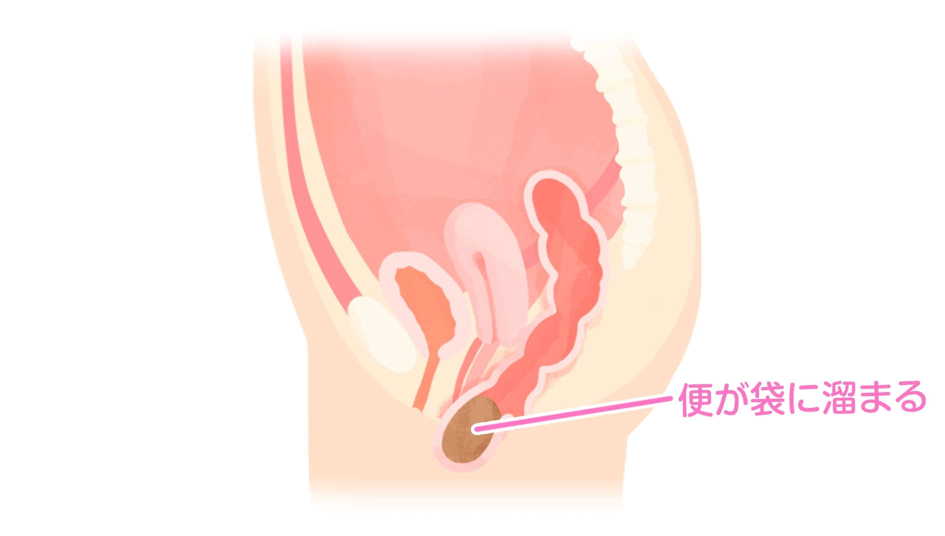 記事画像